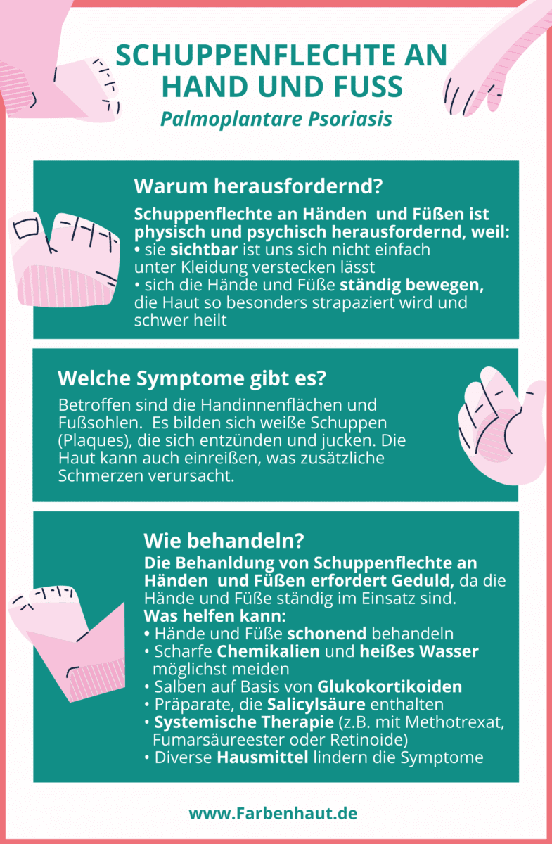 Palmoplantare Psoriasis: Wenn Hände und Füßen betroffen sind